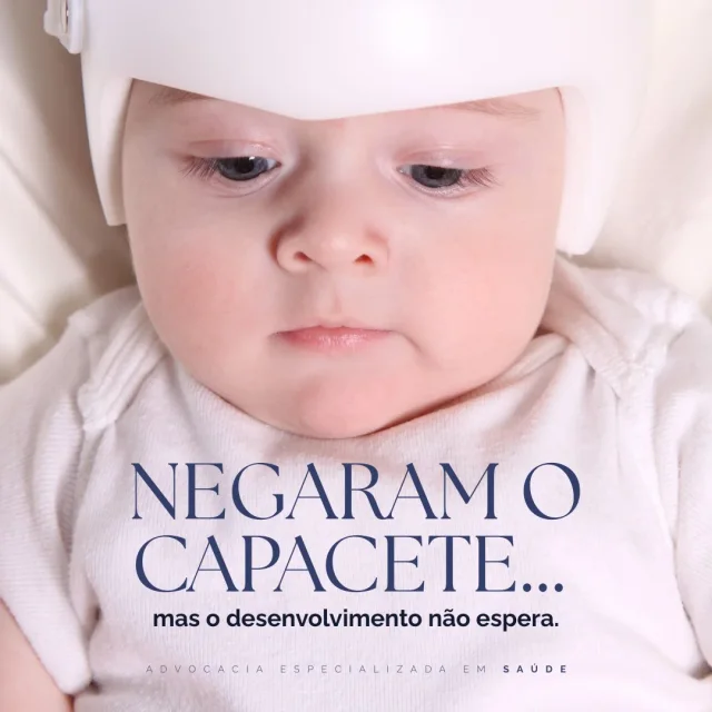 Bebê usando órtese craniana. Peça da Senna Advocacia: “Negaram o capacete… mas o desenvolvimento não espera.”