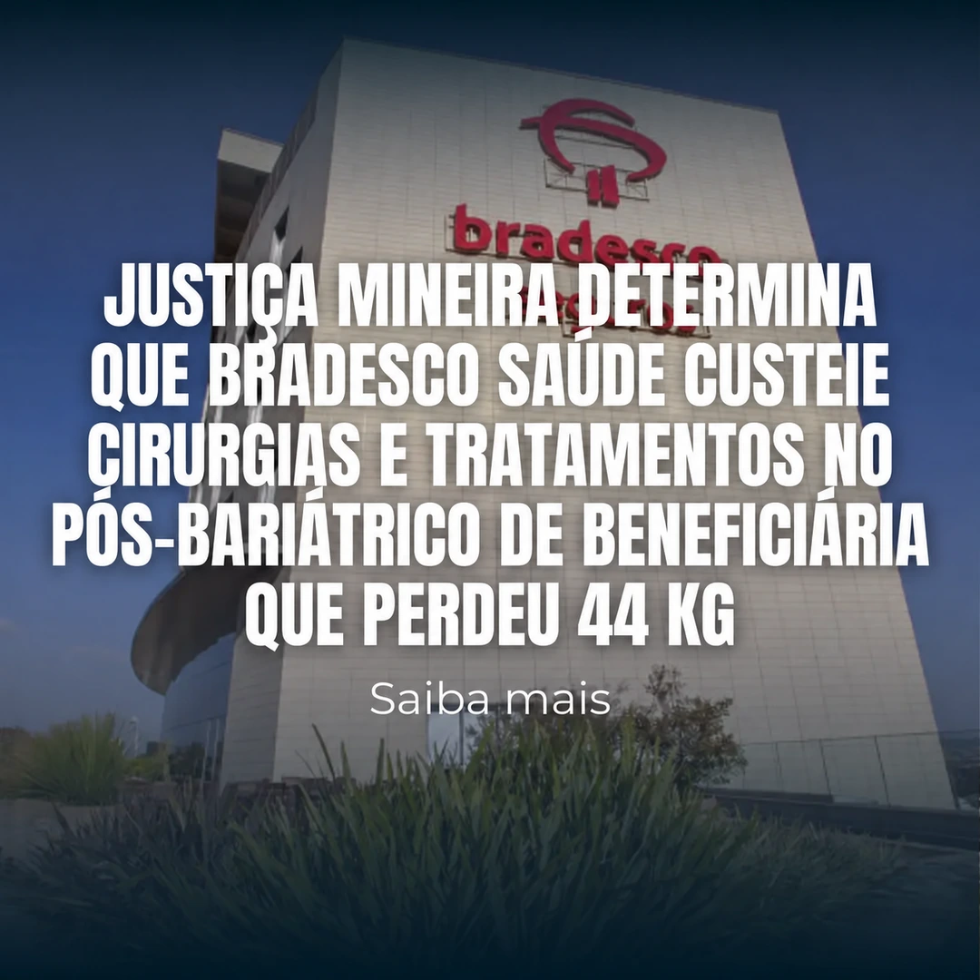 Justiça mineira determina que Bradesco Saúde custeie cirurgias e tratamentos no pós-bariátrico de beneficiária que perdeu 44 kg